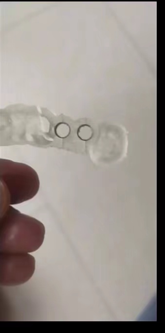 Resin Dental 3D Printer Planti - đánh giá và giá 3D Printing Guide